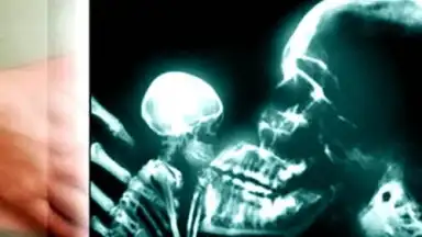 Captura de tela de веселые рентгеновские лучи 3
