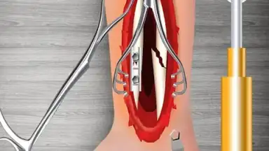 Captura de tela de WristSurgeryDoctor 15