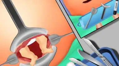 Captura de tela de EmergencySurgery 2