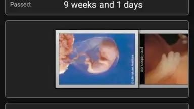 Captura de tela de Pregnancy Assistant 3