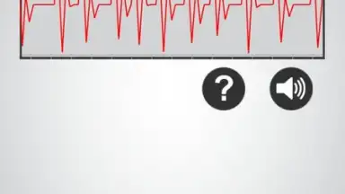 Captura de tela de Monitor Heart Rate 4