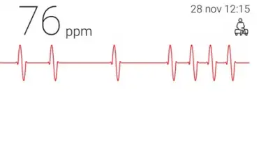 Captura de tela de Cardiograph 2