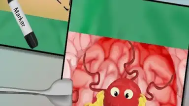 Captura de tela de BrainSurgery 2