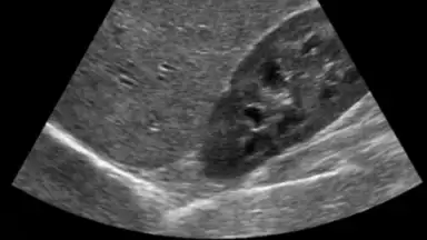 Captura de tela de Scanner X-ray 3