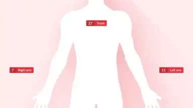 Captura de tela de FotoSkin 6