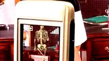 Captura de tela de веселые рентгеновские лучи 4