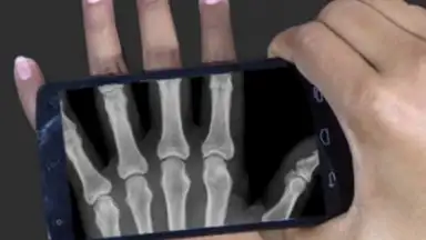 Captura de tela de X Ray Scanner Pro 2